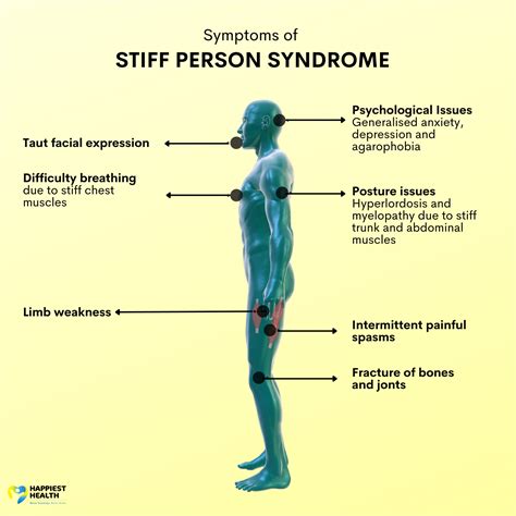 sps syndrome celine|Autoimmune Stiff Person Syndrome: Understanding Why Pain .